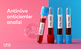 Antinüvə anticismlər (ANA) analizi nədir?